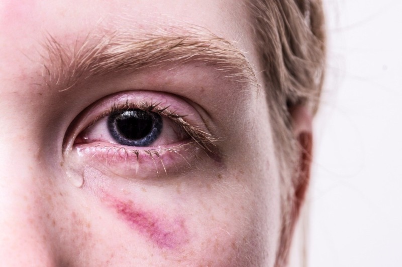 eye-problems-618eb3249ce2d.jpg
