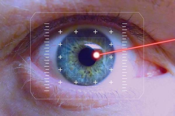 Process of Laser Eye Surgery